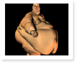 essay on obesity